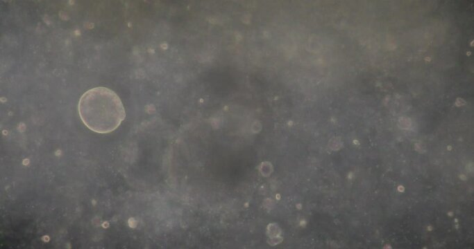 Amoebae move and feed by using pseudopods, which are bulges of cytoplasm formed by the coordinated action of actin microfilaments pushing out the plasma membrane that surrounds the cell.
