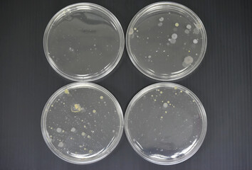 Colonies of bacteria in petri dish.