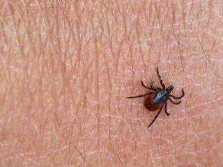 deer tick, ixodes ricinus, on human skin background with copy space