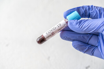 Obraz premium Coronavirus testing