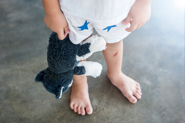 Penang, Malaysia - January 14, 2020 : Sad little asian orphan toddler holding a teddy bear with a sense of hopelessness.