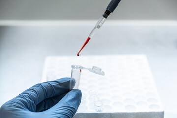 a scientist in blue gloves gently squeezes a red liquid from a pipette into a container. there’s a red drop on the end of the pipette. measure & analysis  for healtcare & medicine