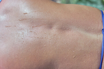 Womens open back with drops of sweat. Sunny summer day, close-up