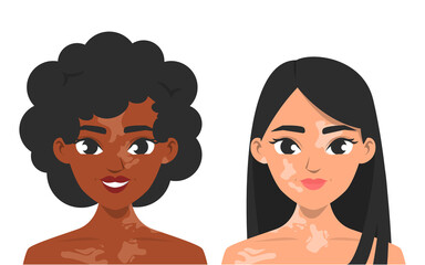 Women with vitiligo vector isolated. Skin pigmentation