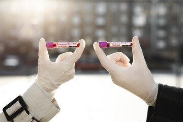 Hands man and woman holds a test tube containing a blood sample, test tube with blood for Covid-19 analyzing. Laboratory testing patient’s blood