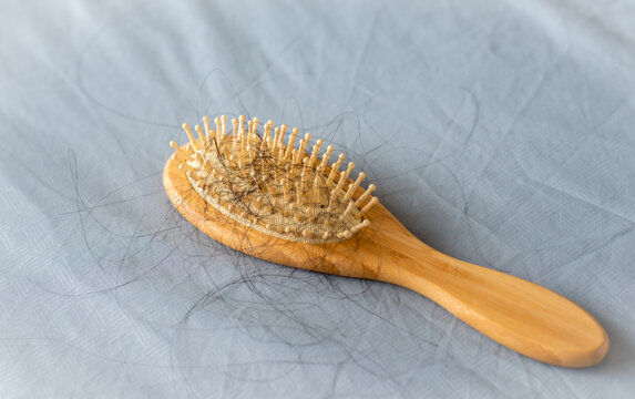 Dirty Wooden Hairbrush With The Fall Out Hair. Hair Loss Problem