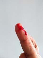 The wound on the finger is bleeding.