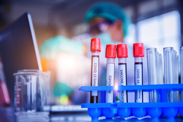 Blood sample research for vaccine corona virus in lab hospital