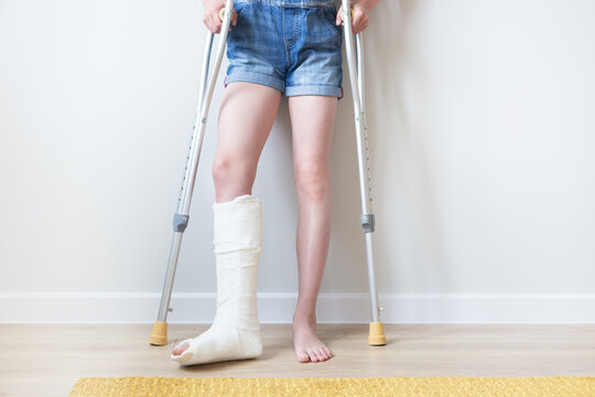 Close-up of children's feet, one leg is broken and in a cast, next to crutches. Light background. 