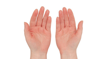 Freckled white hands, Pair of hands come together to make a gentle caring open handed gesture