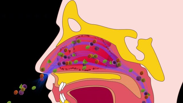 Allergic rhinitis 4K, alpha channel	