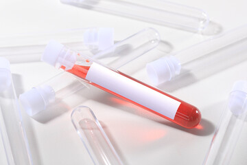 Blood Testing Tubes on White With Label