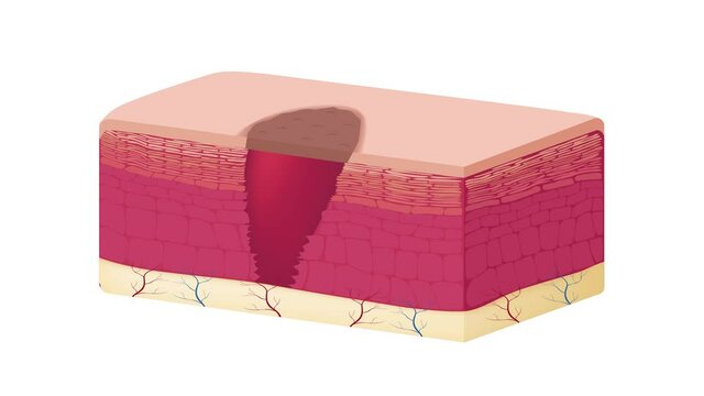 wound skin vector graphic . blood come out of wound graphic animation