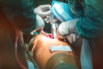Hip joint and bone anatomy concept photo. Doctor hip joint and pelvis bone with ligaments where localized diseases such as dysplasia, fracture, osteoarthritis or replacement