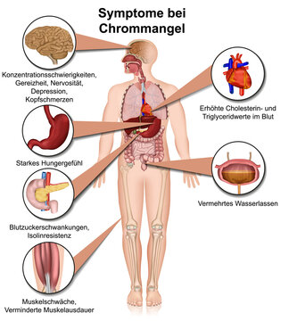 Symptome bei Chrommangel, 3d Infografik isoliert auf wei&szlig;en Hintergrund mit Beschreibung in deutsch