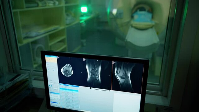 Monitor with x-ray photo in medical control room. Doctor looking at computer screen while patient in MRI machine in hospital.