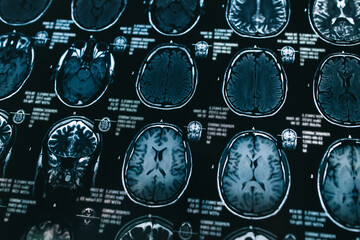 Magnetic resonance scan of the brain. X-ray, medicine, science