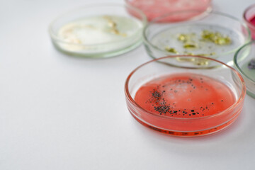 Viruses and bacteria in a Petri dish, studying the growth of bacteria on different samples in the laboratory.