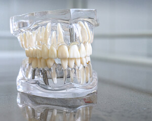 Fototapeta na wymiar Close-up of a dental model, white plastic teeth. Human jaw for dentistry training.