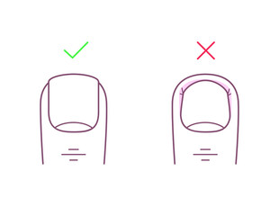 How to trim your toenails correctly. Proper and improper trimming of nails. Line illustration of cut straight and cut too deep. Pedicure, manicure, beauty spa salon