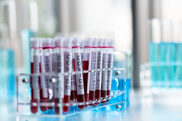 test tubes in laboratory