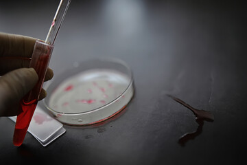 Test tube with patient blood for testing. Analysis for the virus. Coronavirus pandemic laboratory studies. Vaccine development.
