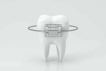 Dental braces and the teeth, 3d rendering.