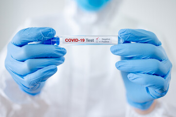 Medical scientist hand in personal protective equipment suit (PPE) wearing blue latex gloves holding COVID-19 Test tube in hospital laboratory. Male doctor getting result of Coronavirus case.