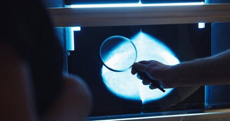 Doctor examines mammogram snapshot of breast of female patient on the monitors with magnifying glass . Breast cancer prevention.