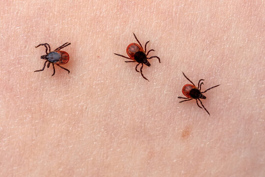 Several Dangerous Ticks Crawl Over Human Skin For A Bite. Insects Parasites Bloodsuckers Attack People In Forest. Danger Of Infection With Encephalitis Or Lyme Disease. Phobia Of Stinging Arachnids