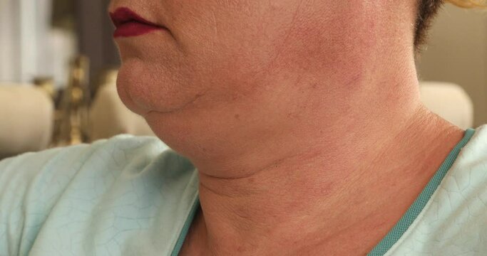 Double chin of a middle eged fat woman Close up shot