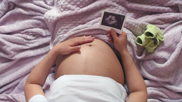 A pregnant woman strokes her stomach and holds a frame from the ultrasound of the child. Top view of a pregnant woman's belly stroking her belly and holding an ultrasound photo