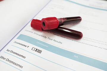 Blood for chromosome testing in Laboratory 