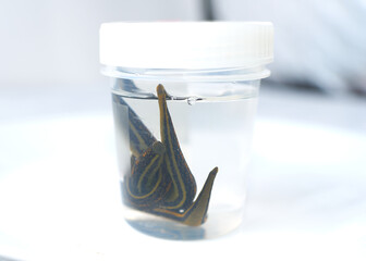 Hirudotherapy. medical leeches in a glass in water