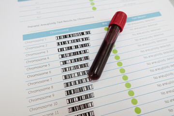Blood for chromosome testing in laboratory