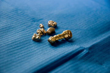 Goldkronen / Zahnfüllungen auf einem blauen Tuch