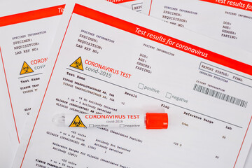 Test tube Covid-19 containing a blood sample on the forms for the coronovirus test analyzing. Laboratory patient’s blood
