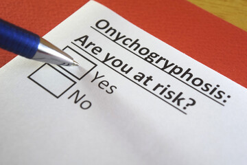 Fototapeta premium One person is answering question about onychogryphosis.