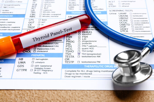 Blood sample in tube with stethoscope and laboratory test form on color background, closeup. Concept of thyroid disease