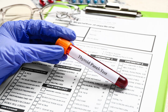 Hand of doctor with blood sample in tube and laboratory test form, closeup. Concept of thyroid disease