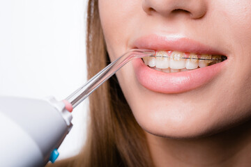 Close-up portrait of a girl washing an oral cavity and braces with an irrigator for dental health - obrazy, fototapety, plakaty