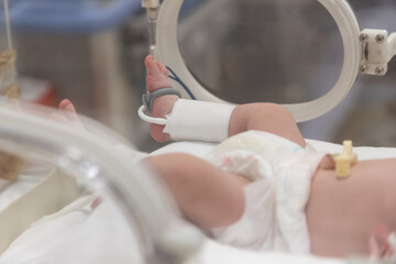 leg cuff for blood pressure on new born in incubator. blood pressure equipment in NICU of hospital.