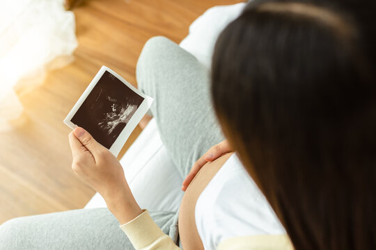 Pregnant asia mother looking sonogram or ultrasound scan photo of embryo baby. Beautiful woman touch her belly and feel love or admire her baby or fetus so much. Pregnancy sit on bed. selective focus