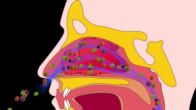 Allergic rhinitis HD alpha channel	