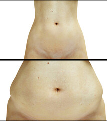 Fat nude women. Slimming and obesity process. Women weight loss success. Diet and health concept. Isolate. 3d rendering.