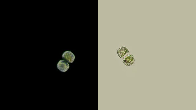 Infusoria Coleps under the microscope, family Colepidae, class Prostomatea, feeds on bacteria, algae, living and dead ciliates, are scavengers of the micro world, on the video we see reproduction by d