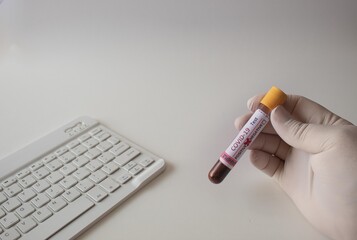 covid19 positive test