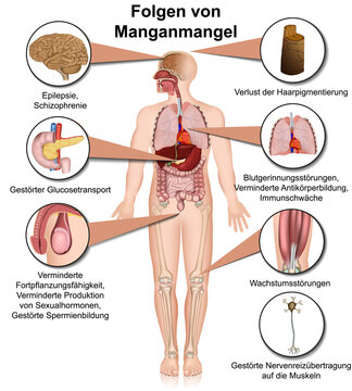 Folgen von Manganmangel, 3D Infografik mit Beschreibung in deutsch, isoliert auf wei&szlig;en Hintergrund