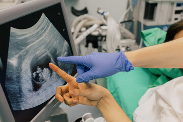 Crop unrecognizable doctor in blue glove pointing with indicate finger at computer screen while showing anonymous patient fetus during ultrasound test in clinic