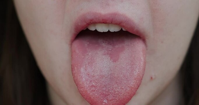 close-up of the girl's mouth shows the tongue
